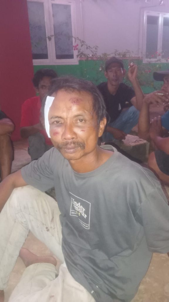 Salah Satu Korban Kekerasan