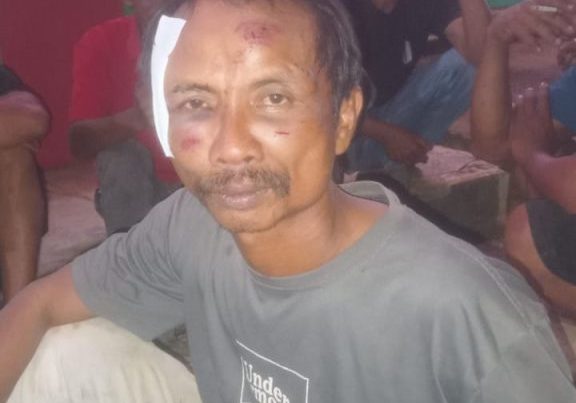 Salah Satu Korban Kekerasan